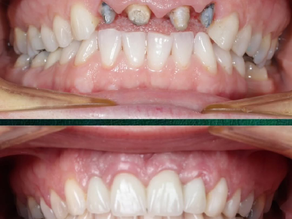 טיפולי שיניים